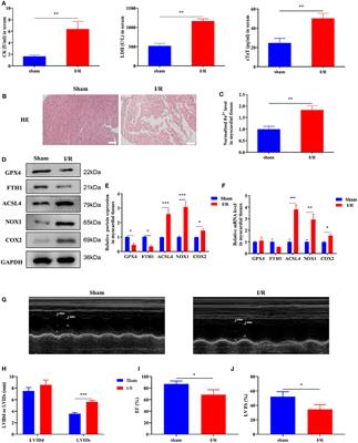 miR-135b-3p Promotes Cardiomyocyte Ferroptosis by Targeting GPX4 and Aggravates Myocardial Ischemia/Reperfusion Injury